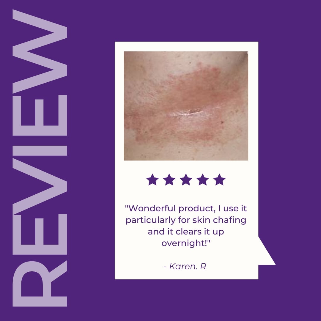 Customer Review " Wonderful product, I use it particularly for skin chafing and it clears up overnight!" - Karen.R